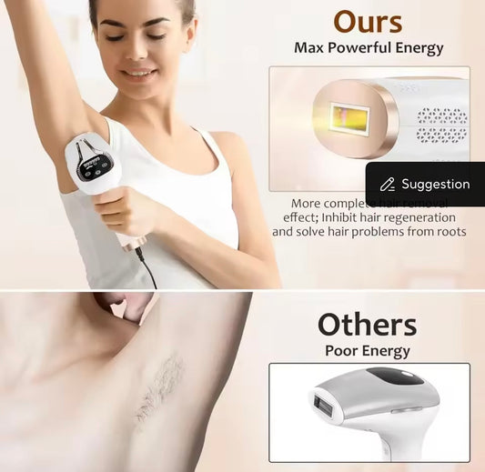 Le LumiSkin™ Épilateur IPL